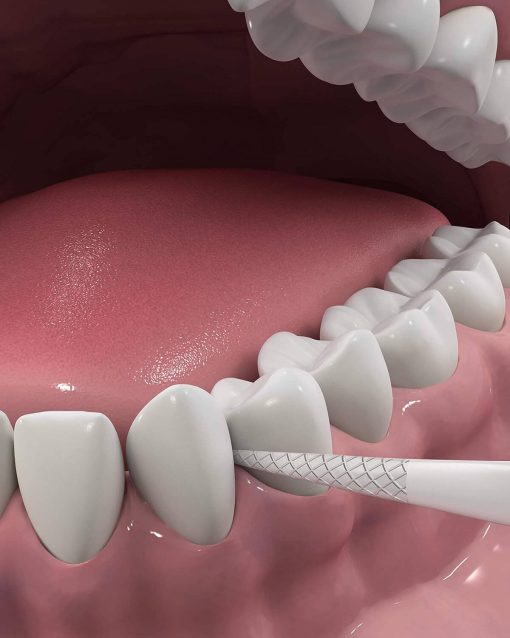 Tăm chỉ Dentek eco-friendly sensitive clean làm trắng răng